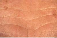 human skin wrinkled 0004